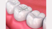 Comfort Care Dental
