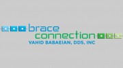 Brace Connection