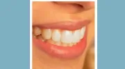 Pioneer Valley Dental Arts