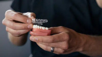 Invisalign