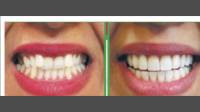 ProCare Family Dental, your trusted destination for exceptional dental care.
