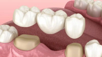 Restorative Dentistry