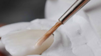 Cosmetic Dentistry