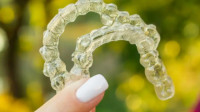 Clear Aligners