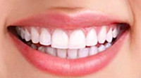 Teeth Whitening in Morton Grove, IL