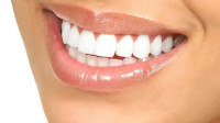 Cosmetic Dentistry
