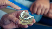 Cosmetic Dentistry