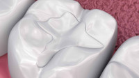 Restorative Dentistry